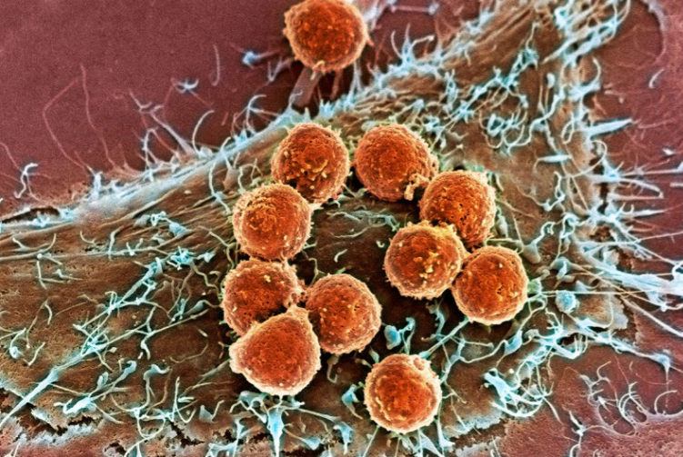 T cells attacking cancer cell.png (1.13 MB)