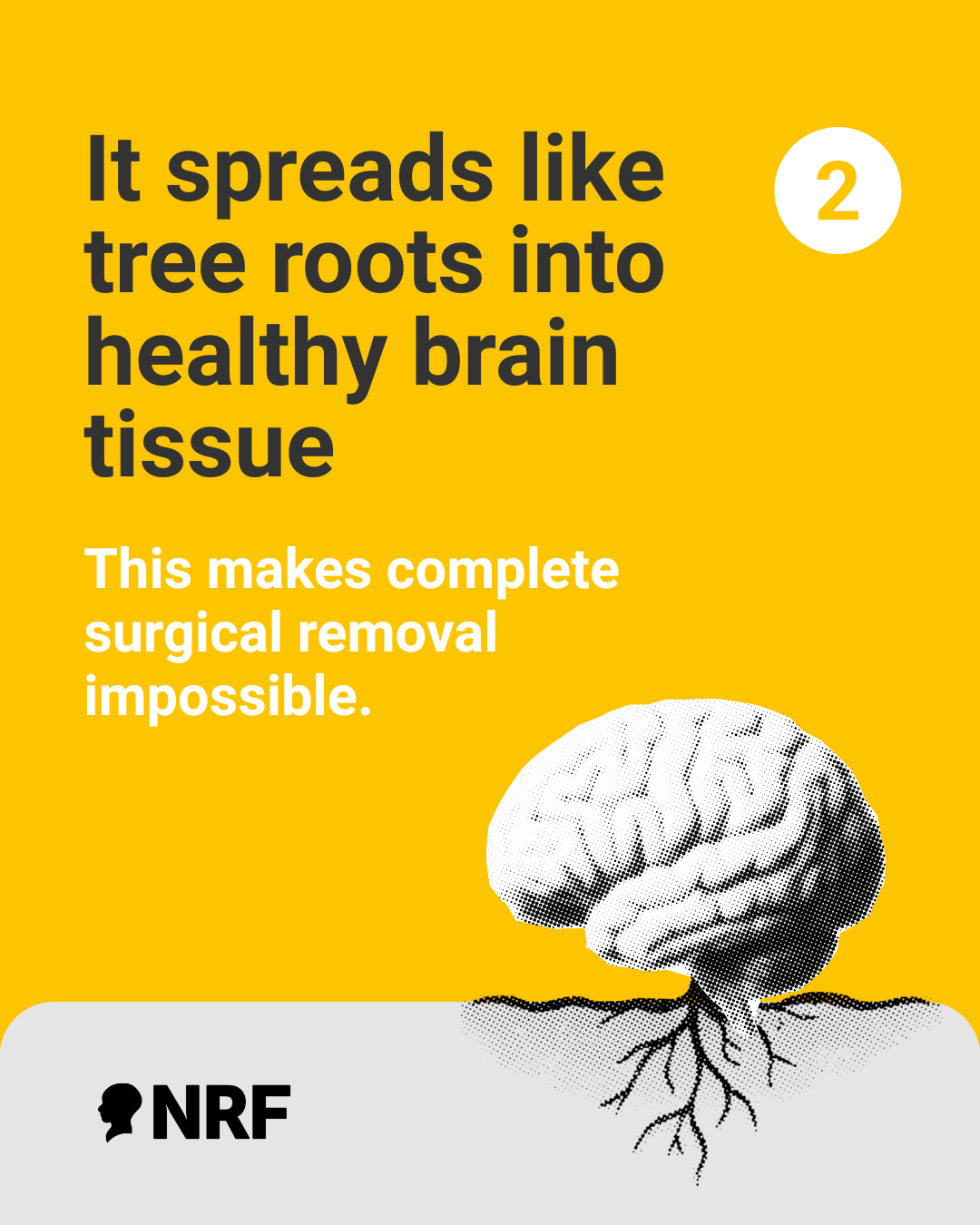 3 - GBM grows like tree roots.png (349 KB)