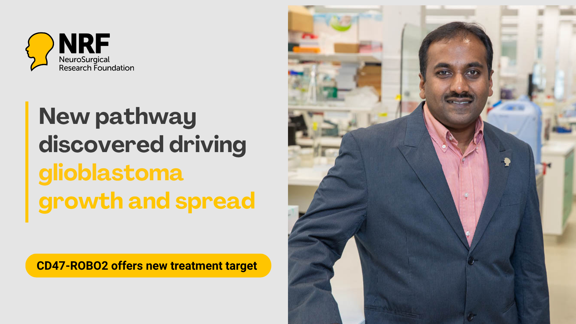 New discovery reveals hidden driver of deadly brain cancer image