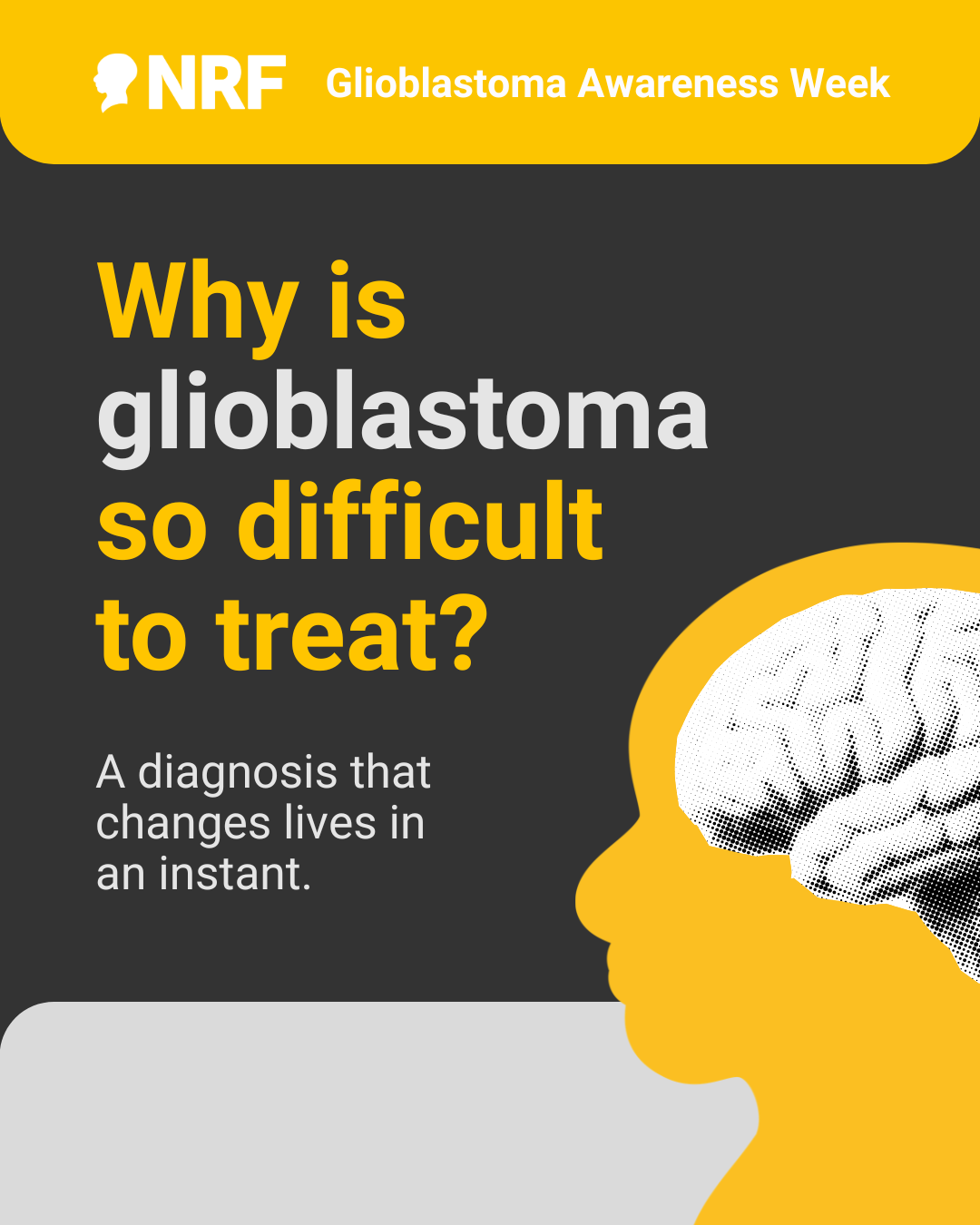 Why is glioblastoma so difficult to treat - no swipe.png (196 KB)