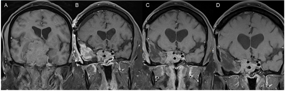 Pituitary 3.png (273 KB)