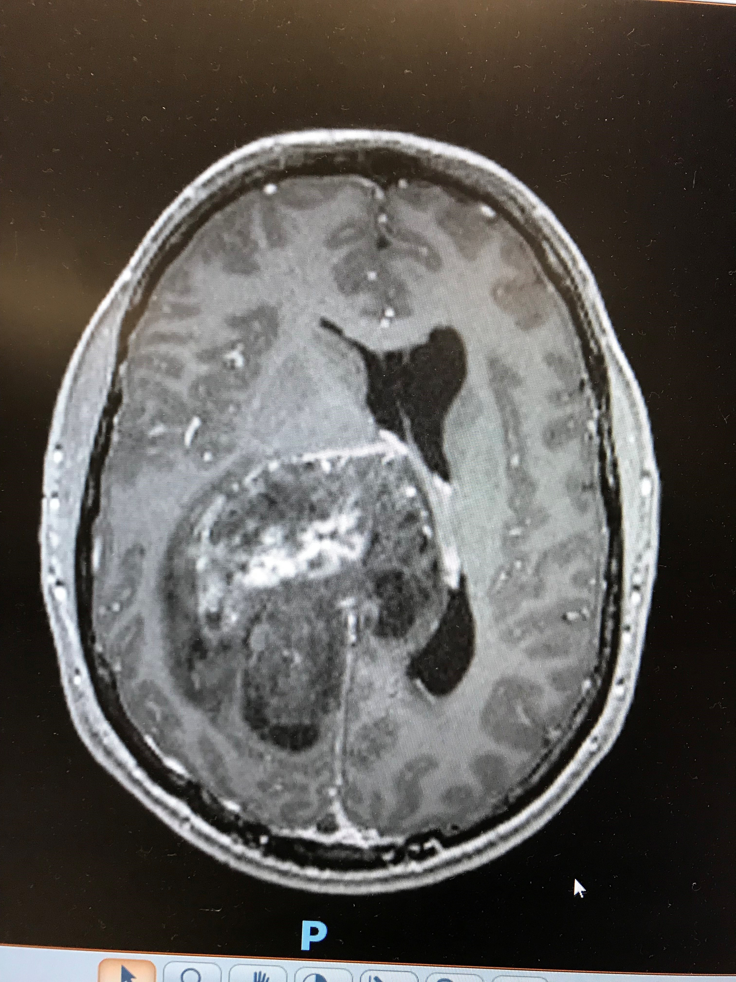 Matt MRI scan.jpg (3.40 MB)