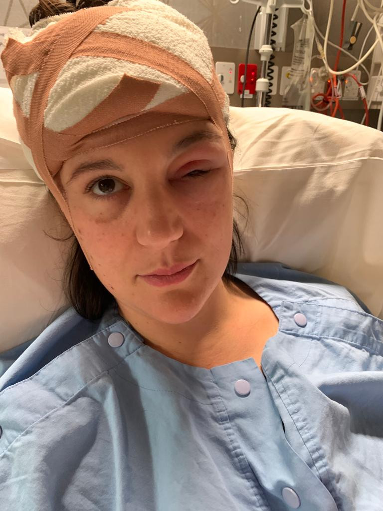 2020 ICU post surgery.jpg (94 KB)